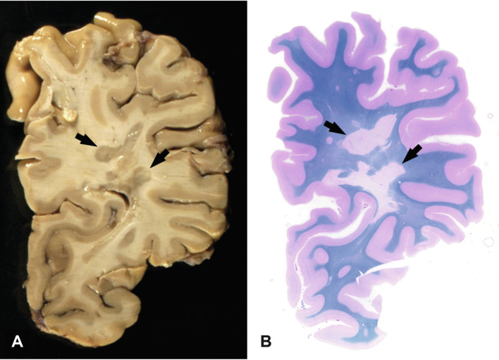 Fig. 19.2