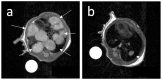 Figure 18