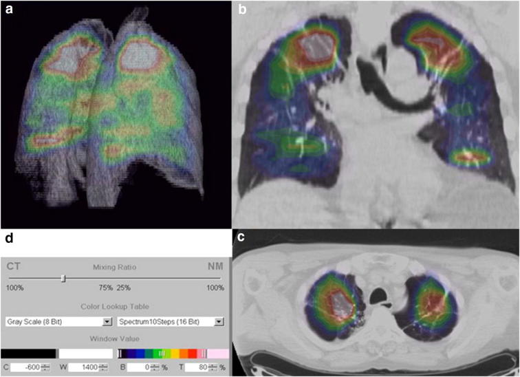 Fig. 3