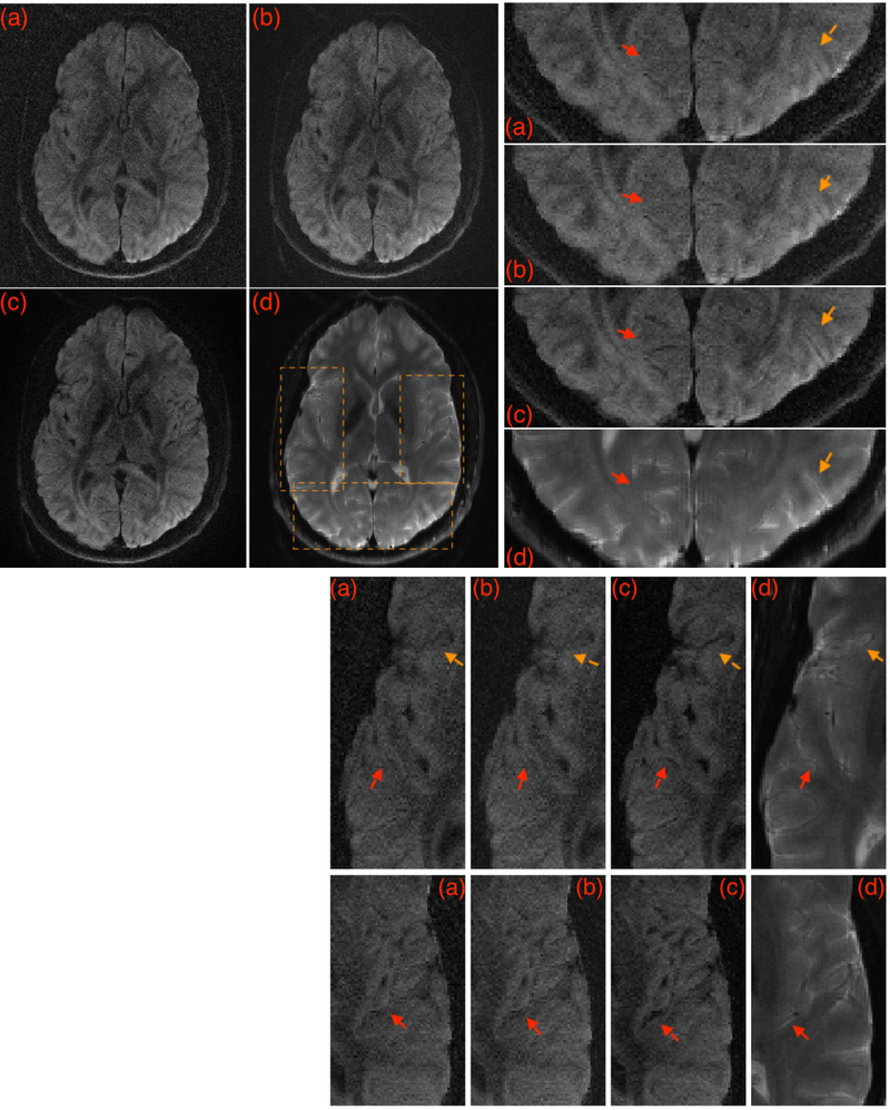 Figure 2: