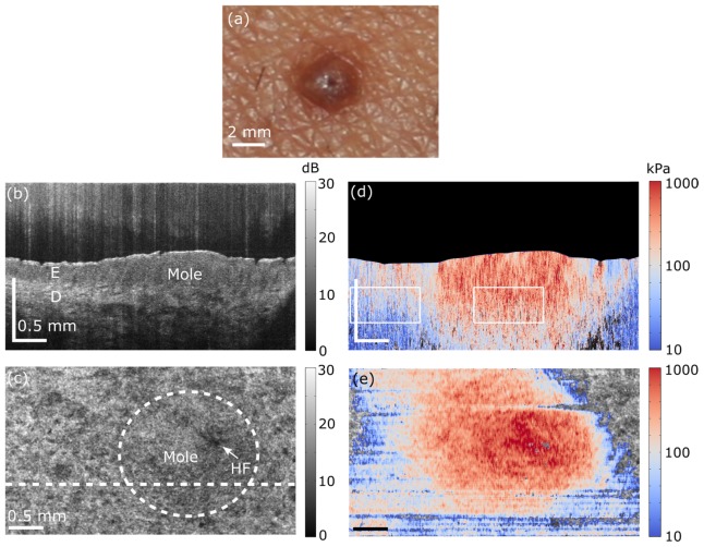 Fig. 4