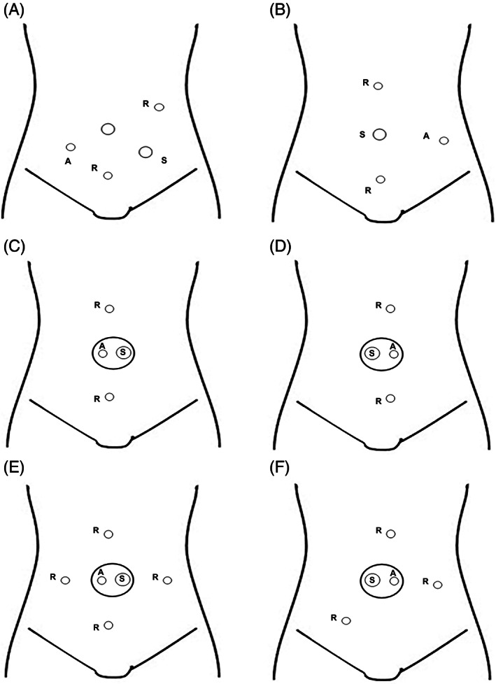 FIGURE 3