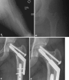 Fig. 4A–D