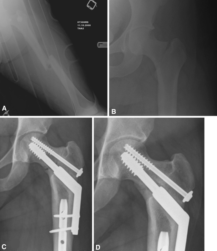 Fig. 4A–D