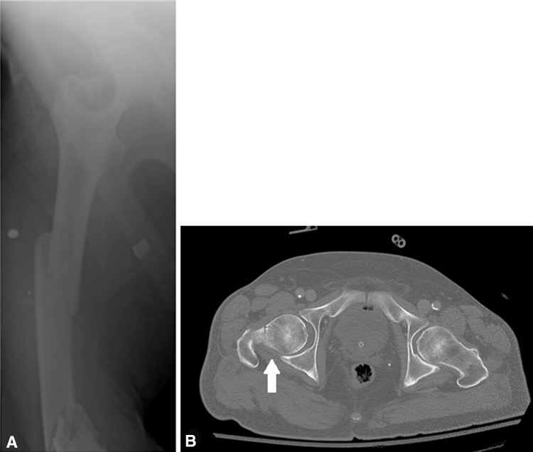 Fig. 1A–B