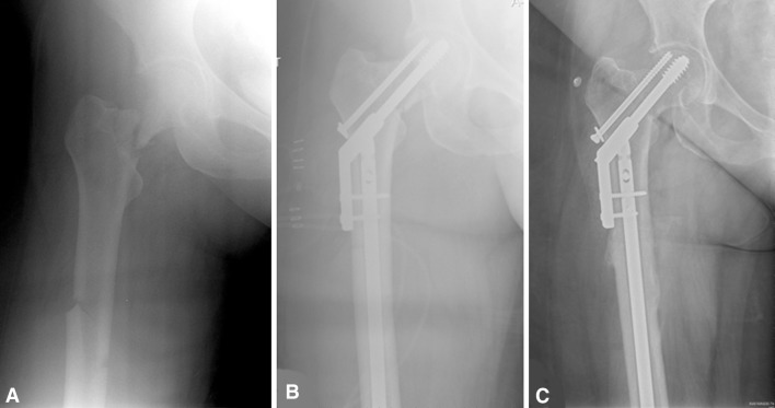 Fig. 2A–C