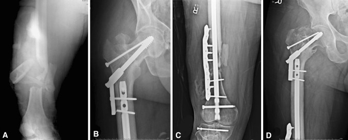 Fig. 3A–D