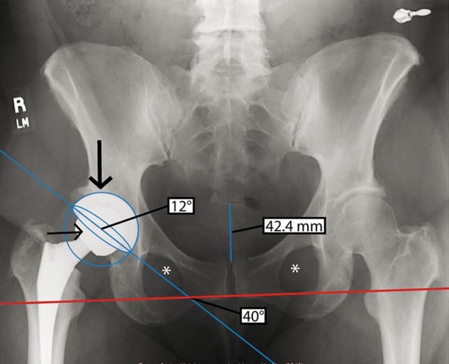 Fig. 2