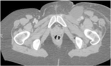 Fig. 1