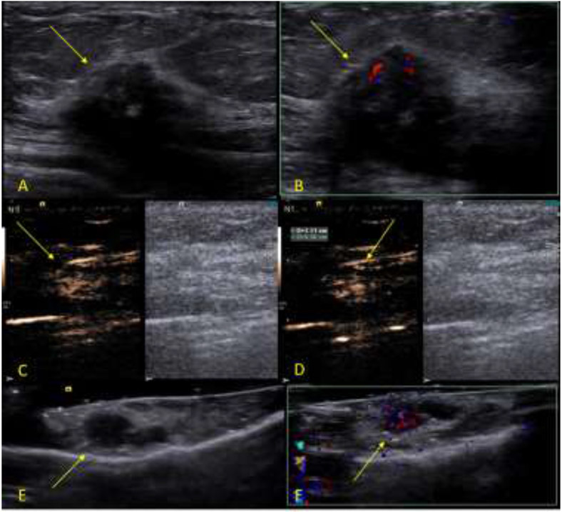 Figure 3: