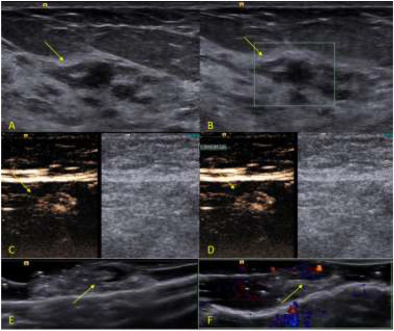 Figure 2: