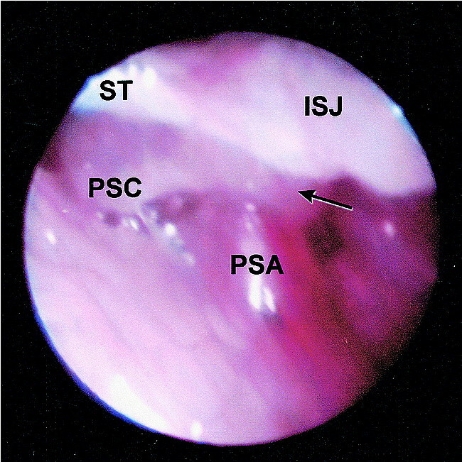 fig 3.