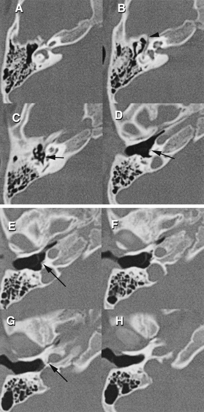 fig 1.