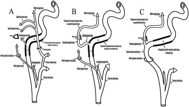 fig 4.