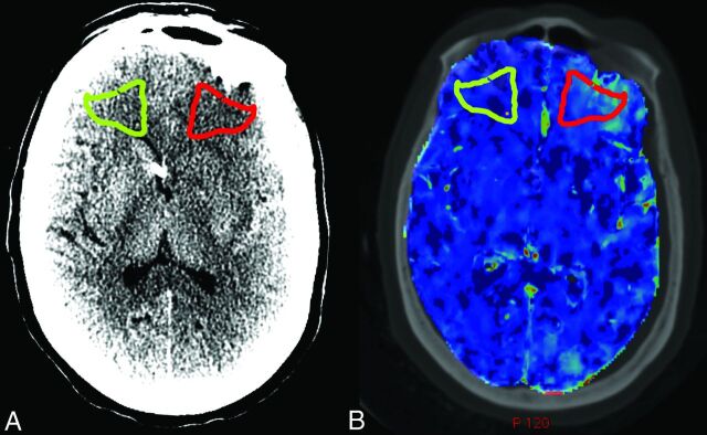 Fig 1.