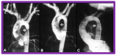 Figure 32