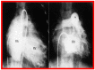 Figure 45