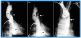 Figure 26