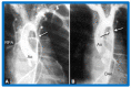 Figure 30