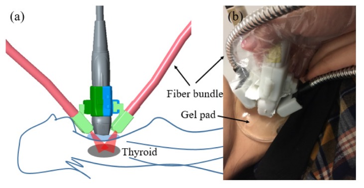 Fig. 2