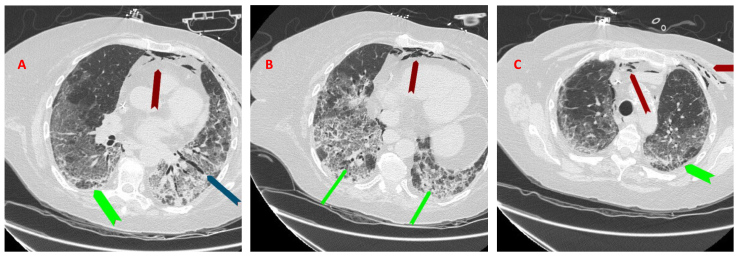 Fig. 2