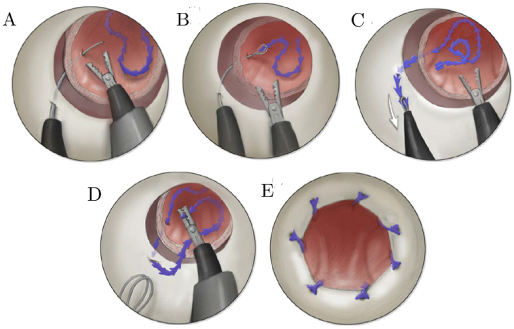 Fig. 1.