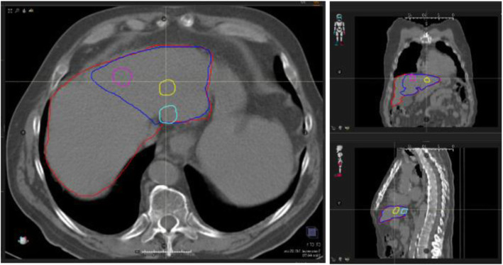 Fig. 1