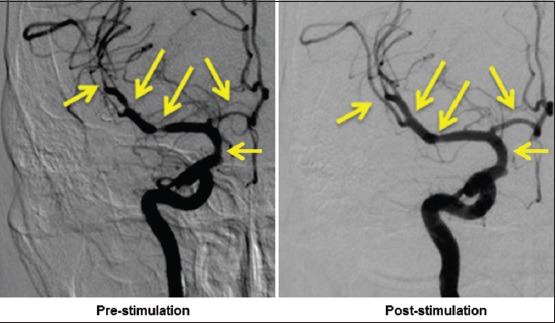 Figure 12