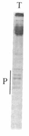 1598