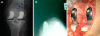 Fig. 2
