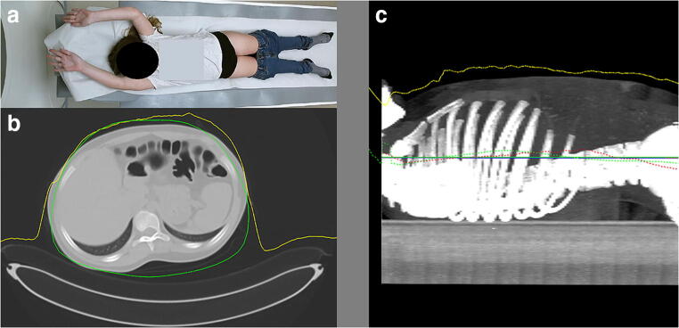 Fig. 4