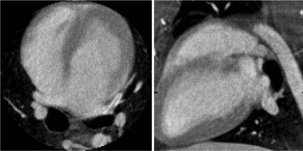 Fig. 13