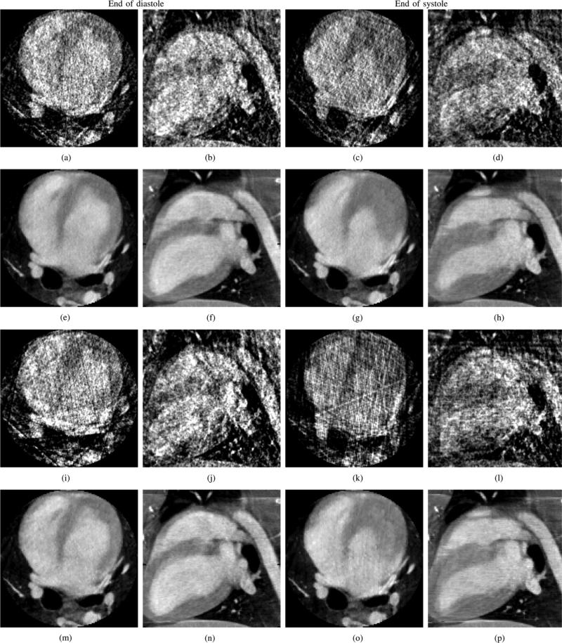 Fig. 12