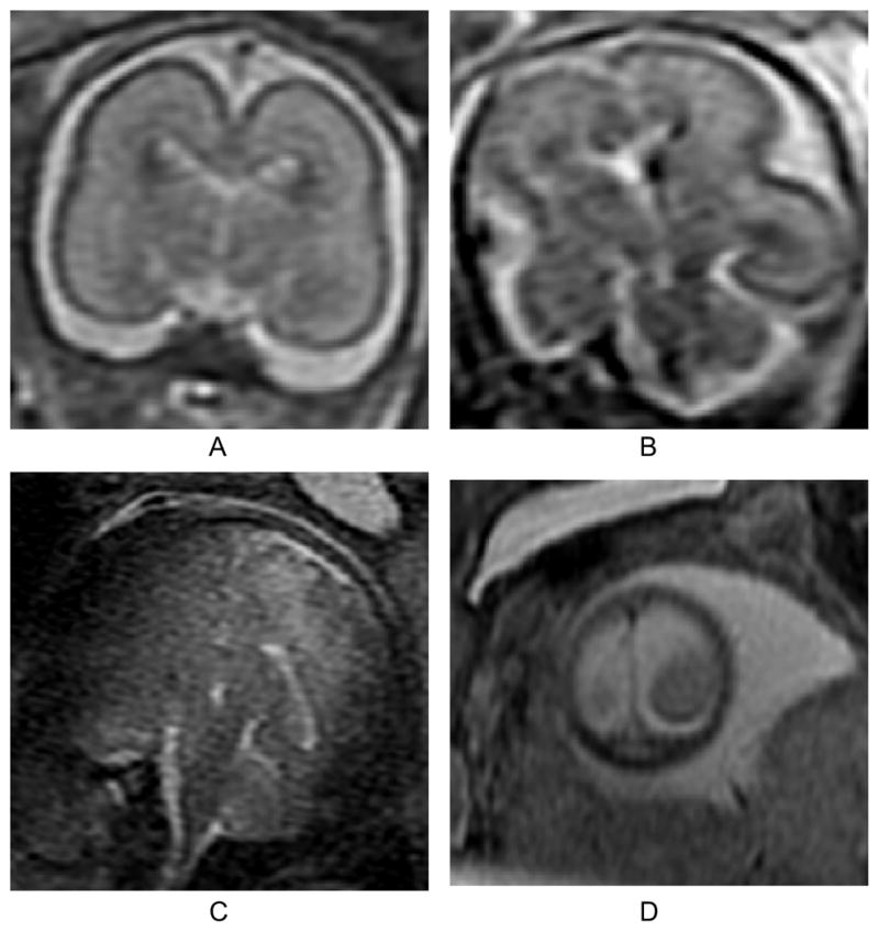 Fig. 16