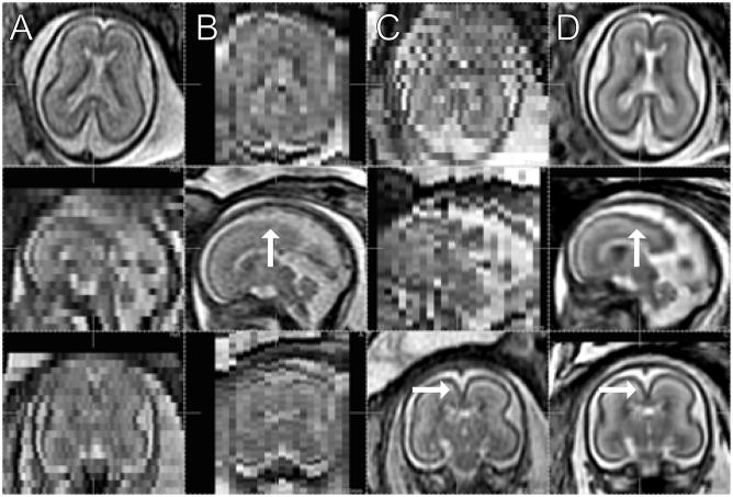 Fig. 14