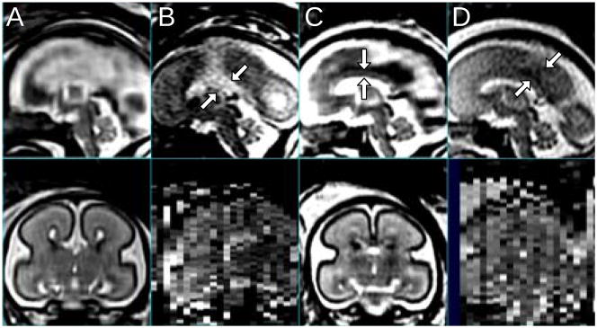 Fig. 18