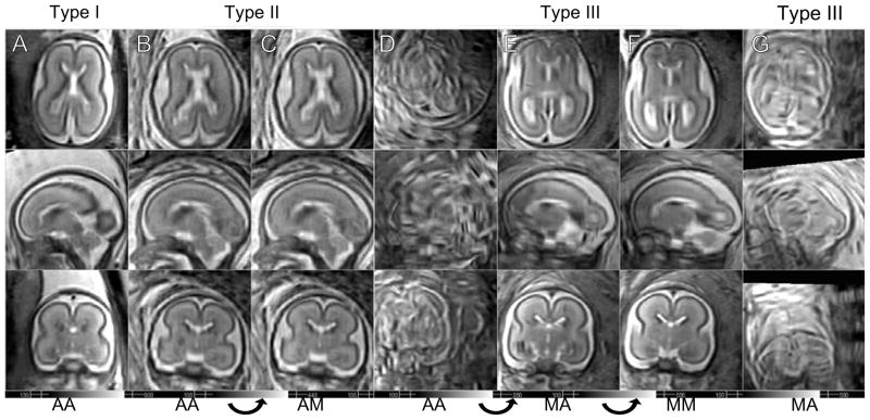 Fig. 13