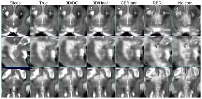 Fig. 12