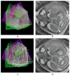 Fig. 15