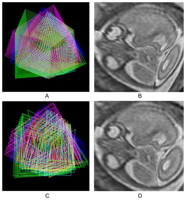 Fig. 15