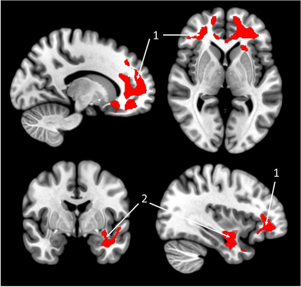 Fig. 2