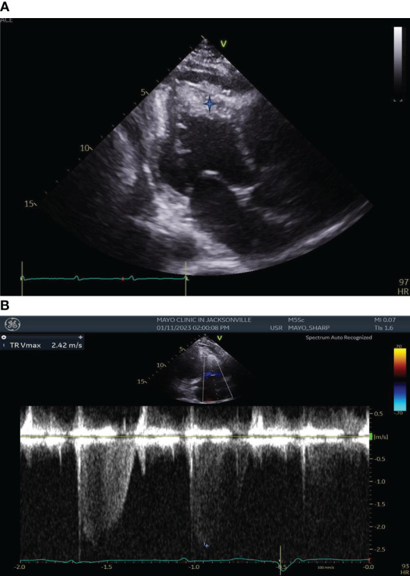 Figure 2