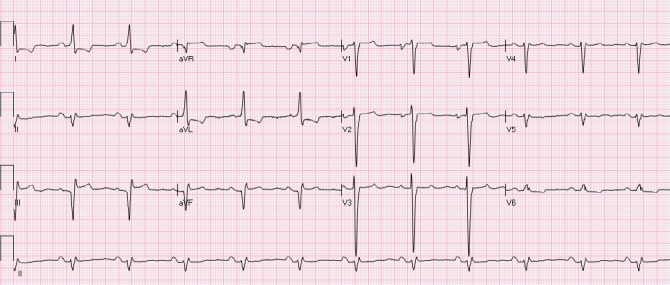 Figure 14