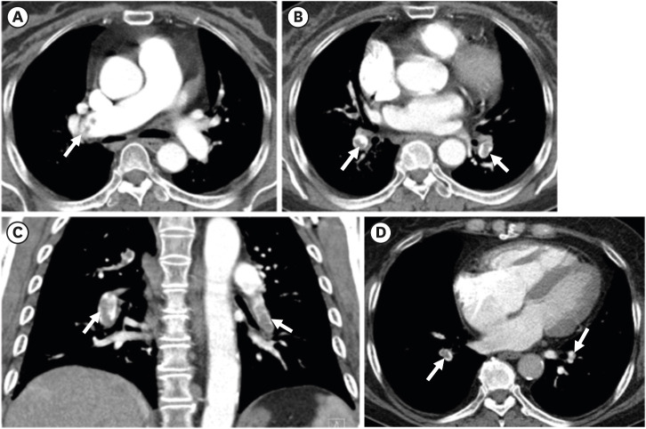 Fig. 10