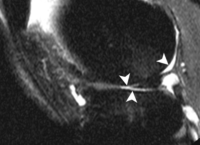 Figure 1b: