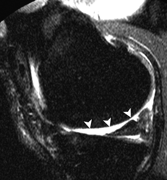 Figure 2c: