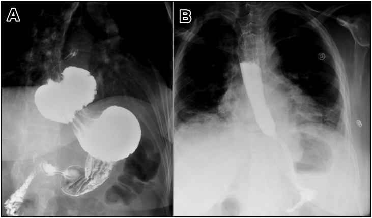 Fig. 1