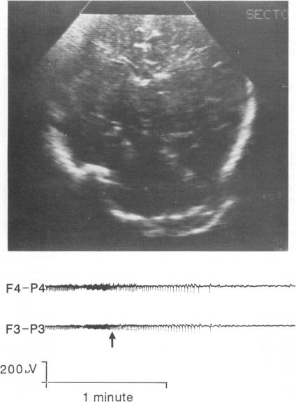 Fig 3(a)