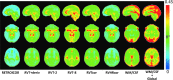 <b>FIG. 1.</b>