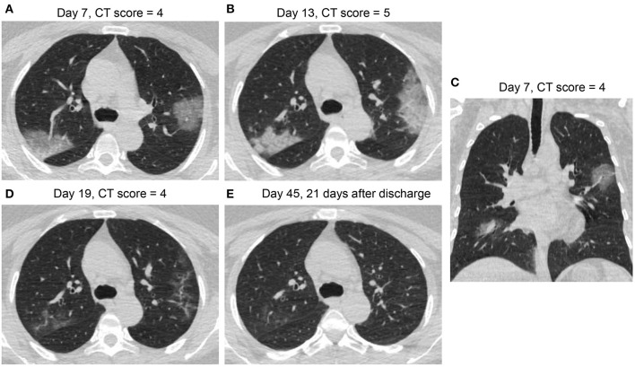 Figure 4